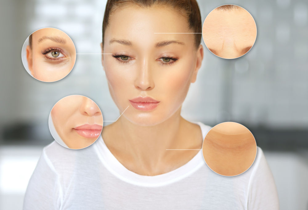 Botox-Behandlung des gesamten Gesichtsbereichs sowie der Achseln.